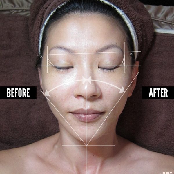 Singapore Top Beauty Blog Anti-Aging Lifting Treatment Glomax Aesthetics